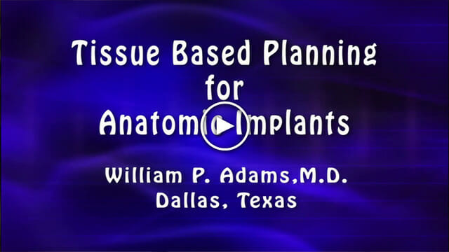 Tissue Based Planning for Anatomic Implants by William P. Adams, M.D.