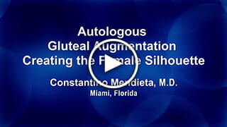 Autologous Gluteal Augmentation - Creating the Female Silhouette by Constantino Mendieta, M.D.