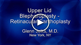 Dr. Jelks: Upper Lid Blepharoplasty - Retinacular Canthoplasty