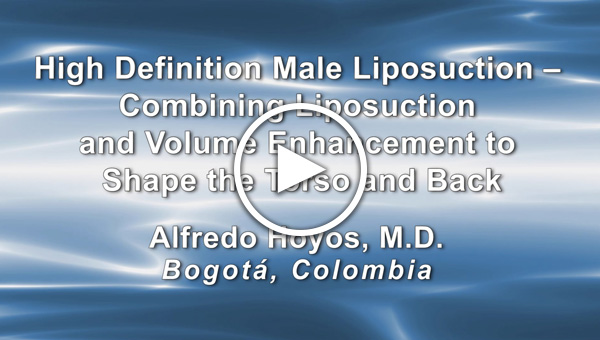 Dr. Alfredo Hoyos: High Definition Male Liposuction