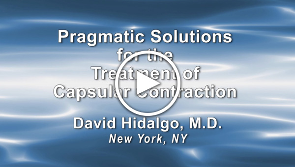 Dr. Hidalgo: Pragmatic Solutions for the Treatment of Capsular Contraction