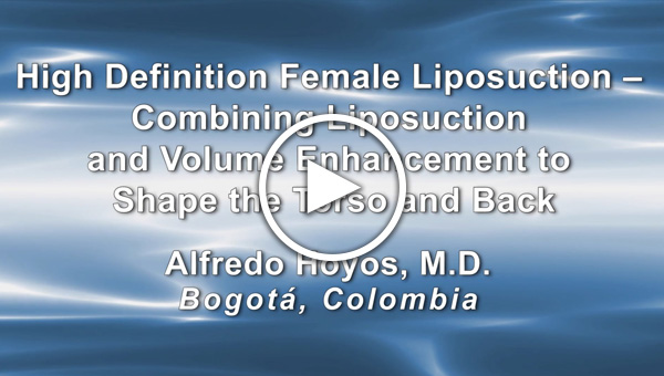 Dr. Alfredo Hoyos: High Definition Female Liposuction