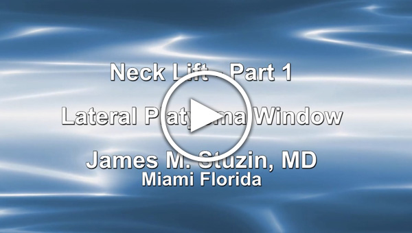 Dr. James M. Stuzin: Neck Lift - Part 1