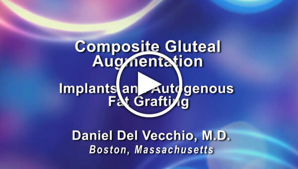 Dr. Daniel Del Vecchio: Composite Gluteal Augmentation - Implants and Autogenous Fat Grafting