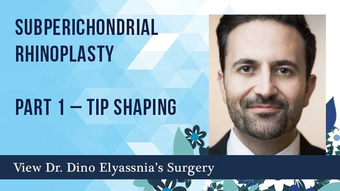 Subperichondrial Rhinoplasty Part 1 – Tip Shaping