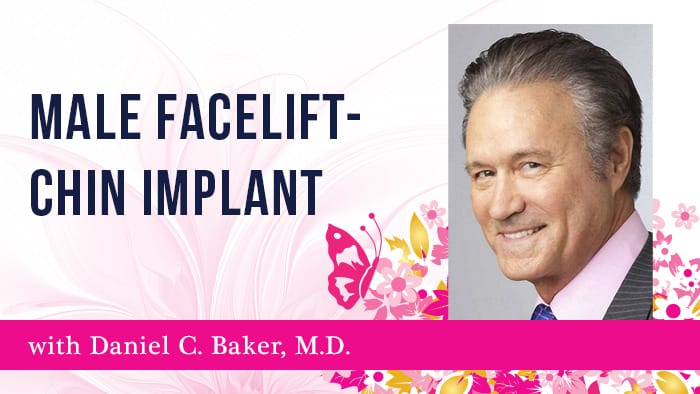 Male Facelift - Chin Implant