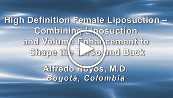 Dr. Alfredo Hoyos: High Definition Female Liposuction