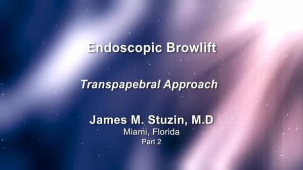 Dr. James M. Stuzin: Endoscopic Brow Lift Part 2