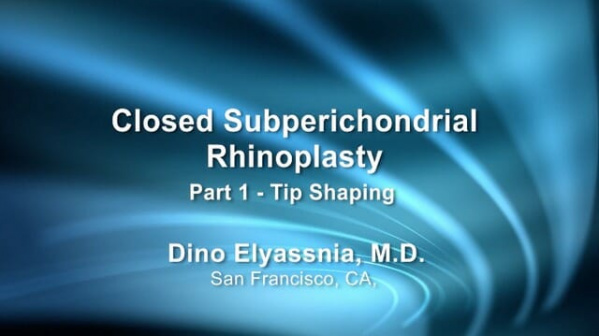 Closed Subperichondrial Rhinoplasty Part 1 - Tip Shaping