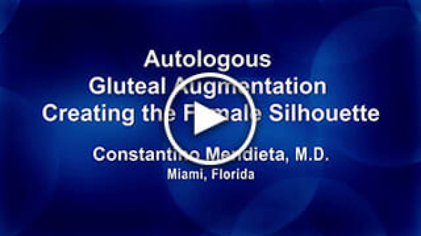 Autologous Gluteal Augmentation - Creating the Female Silhouette by Constantino Mendieta, M.D.