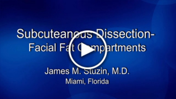 Dr. Stuzin: Subcuteanous Dissection – Facial Fat Compartments