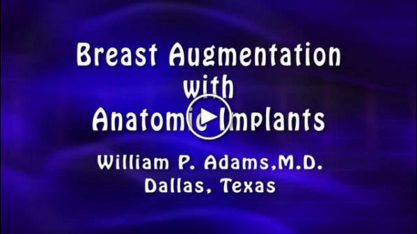 Breast Augmentation with Anatomic Implants by William P. Adams, M.D.