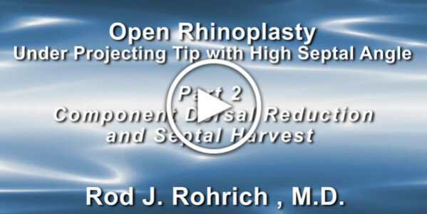Dr. Rohrich: Open Rhinoplasty Part 2: Component Dorsal Reduction Septal Harvest