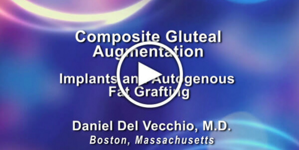 Dr. Daniel Del Vecchio: Composite Gluteal Augmentation - Implants and Autogenous Fat Grafting